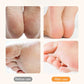 Exfoliante de pies eléctrico recargable